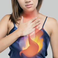 Acid Reflux